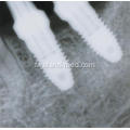واحد دندانپزشکی X-RAY